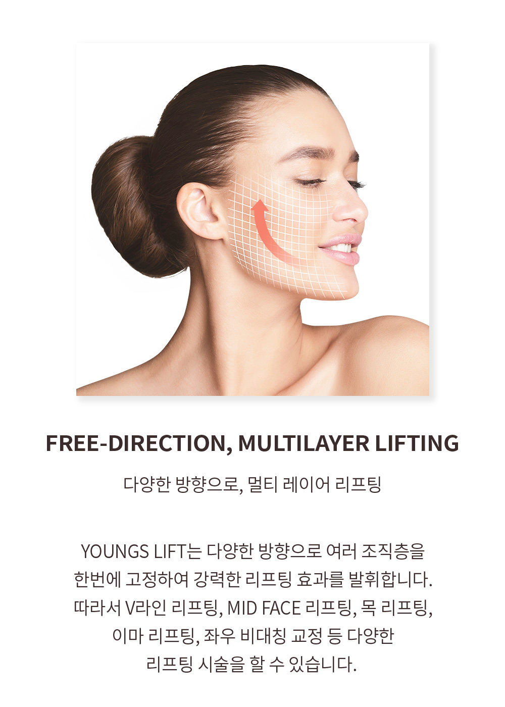 FREE-DIRECTION, MULTILAYER LIFTING